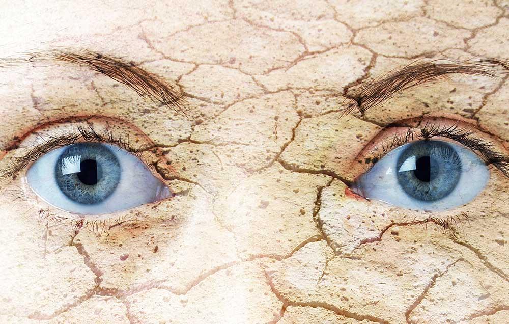 3 Surprising Symptoms of Dry Eyes