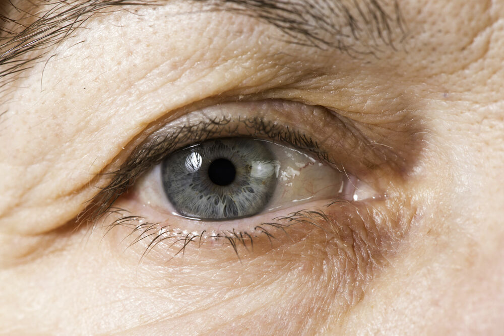 Read more about the article What You Need To Know About Droopy Eyelids