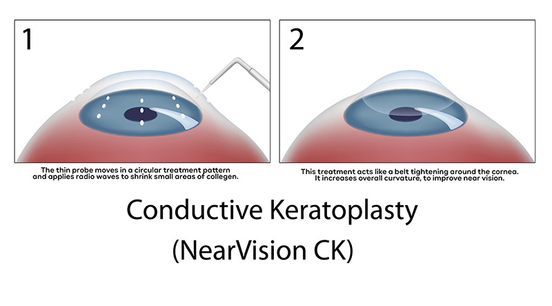 Near Vision CK Eye Clinic of Florida