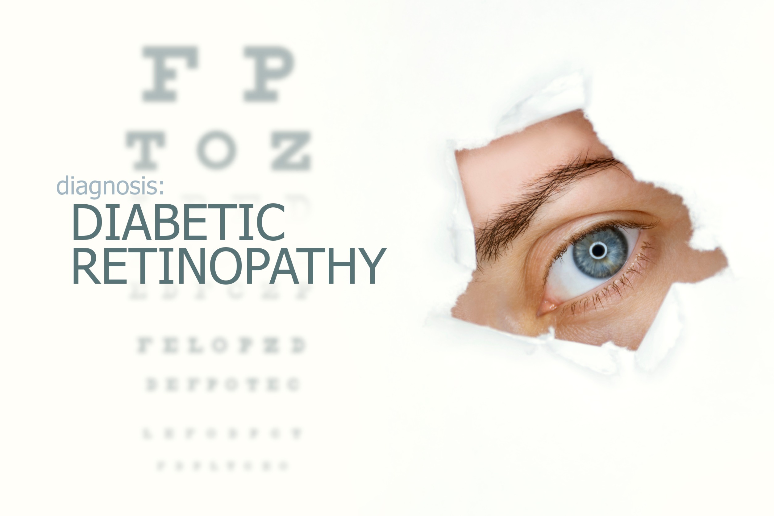 How to Spot the Symptoms of Diabetic Retinopathy