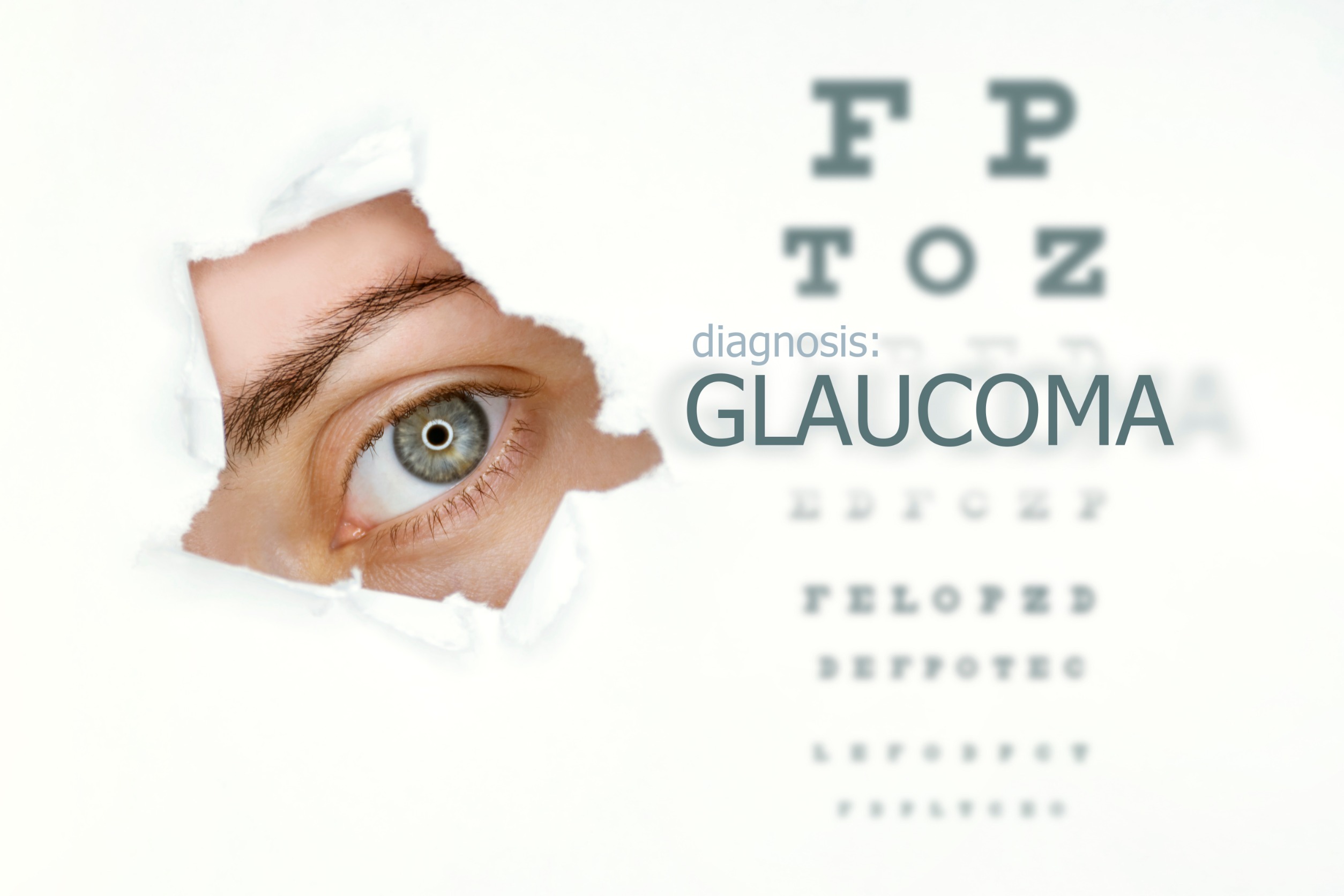 You are currently viewing 8 Things You Can Do Today to Prevent Vision Loss From Glaucoma
